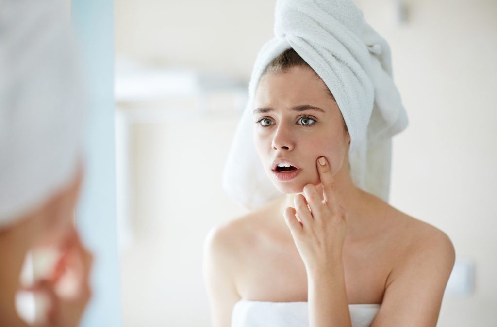 Blackheads Are So Annoying! How To Treat Your Breakouts Effectively