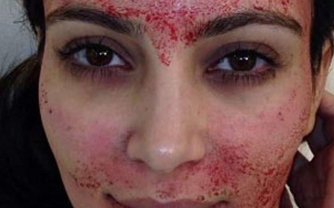 This $1,000 Facial Uses Your OWN Blood